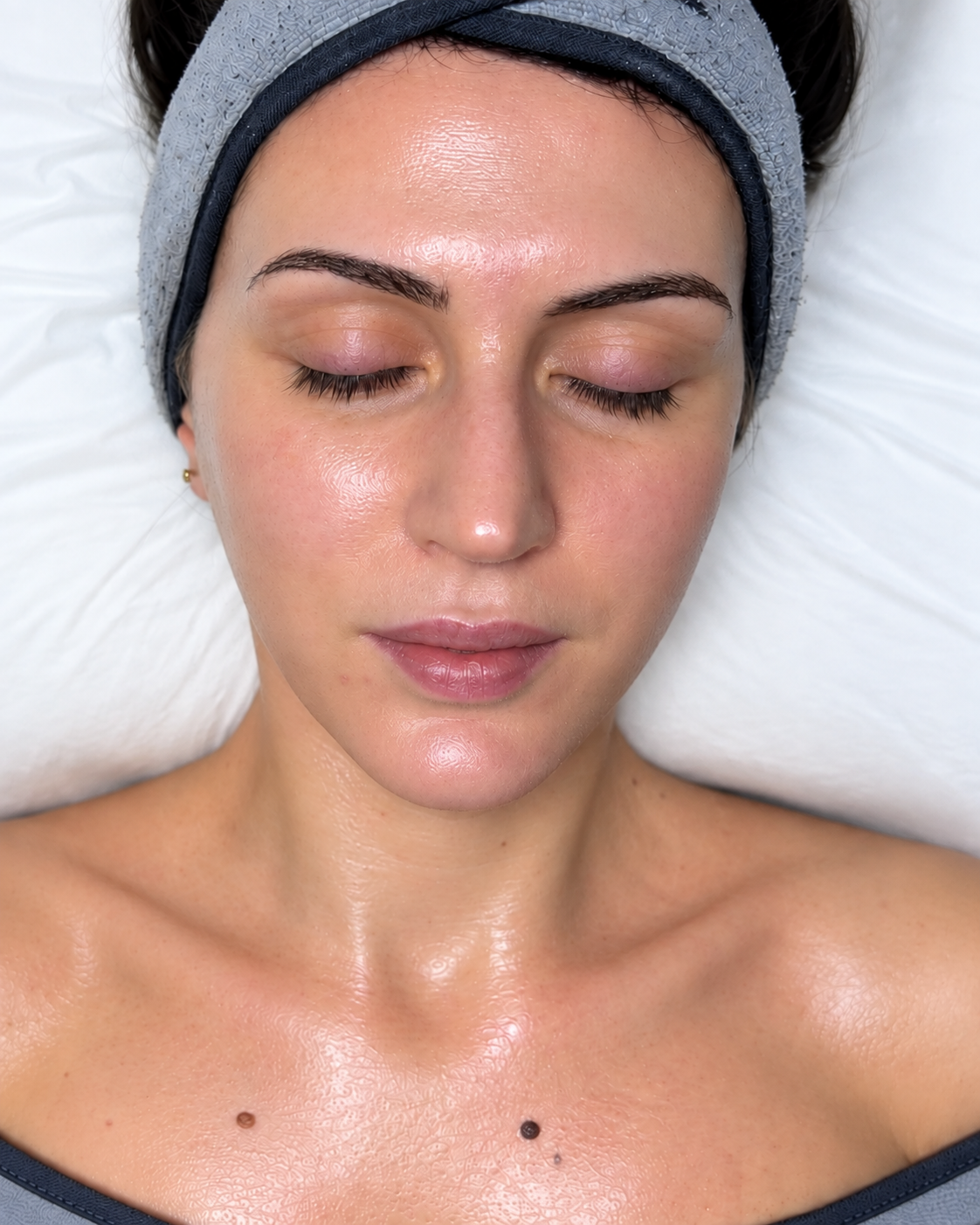 Client after Circadia Peptide Firming treatment
